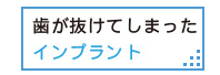 歯が抜けてしまった　インプラント